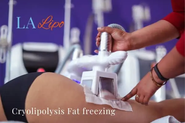 women getting fat freezing Twickenham