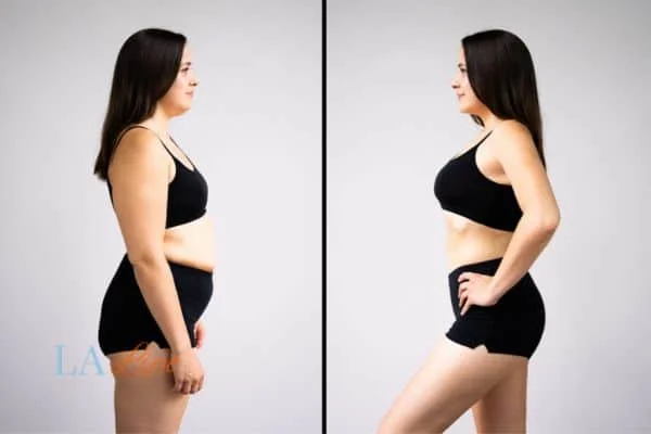 link between body image and mental health Twickenham